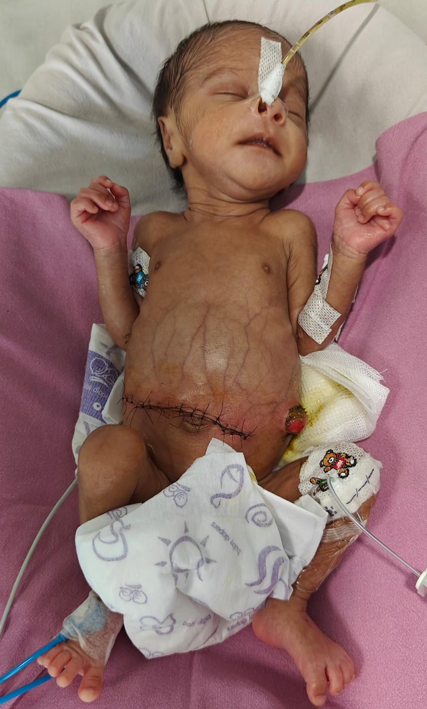 Baby of Manju