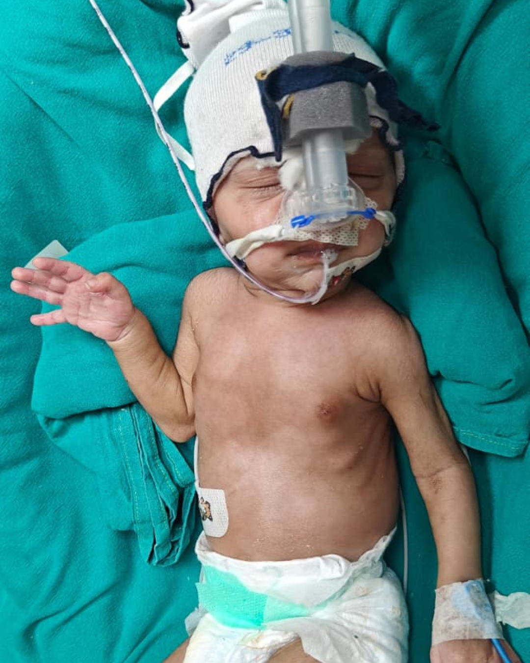 Help Save Baby of Suman