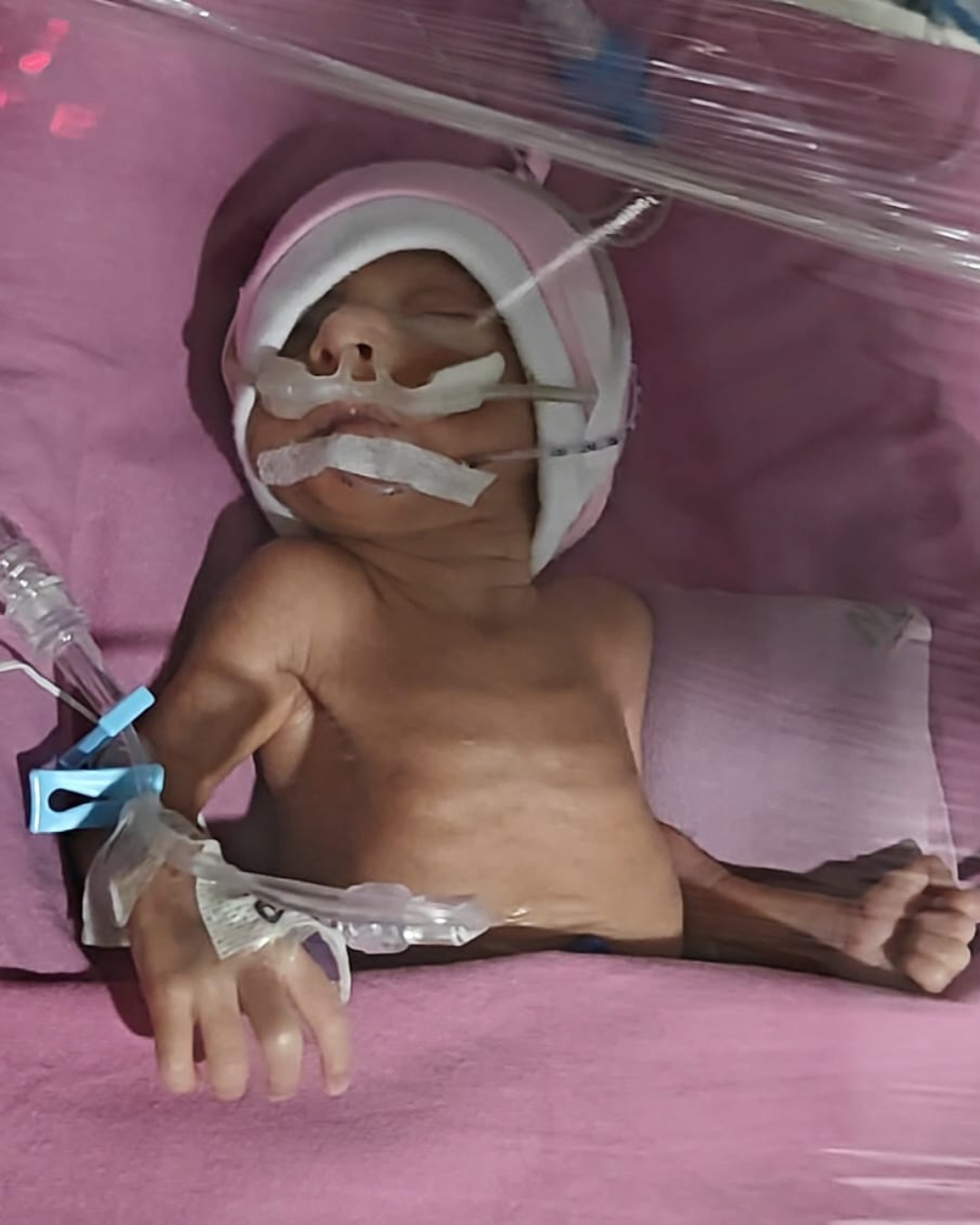 A Tiny Newborn Battling for Survival Help Baby of Pooja