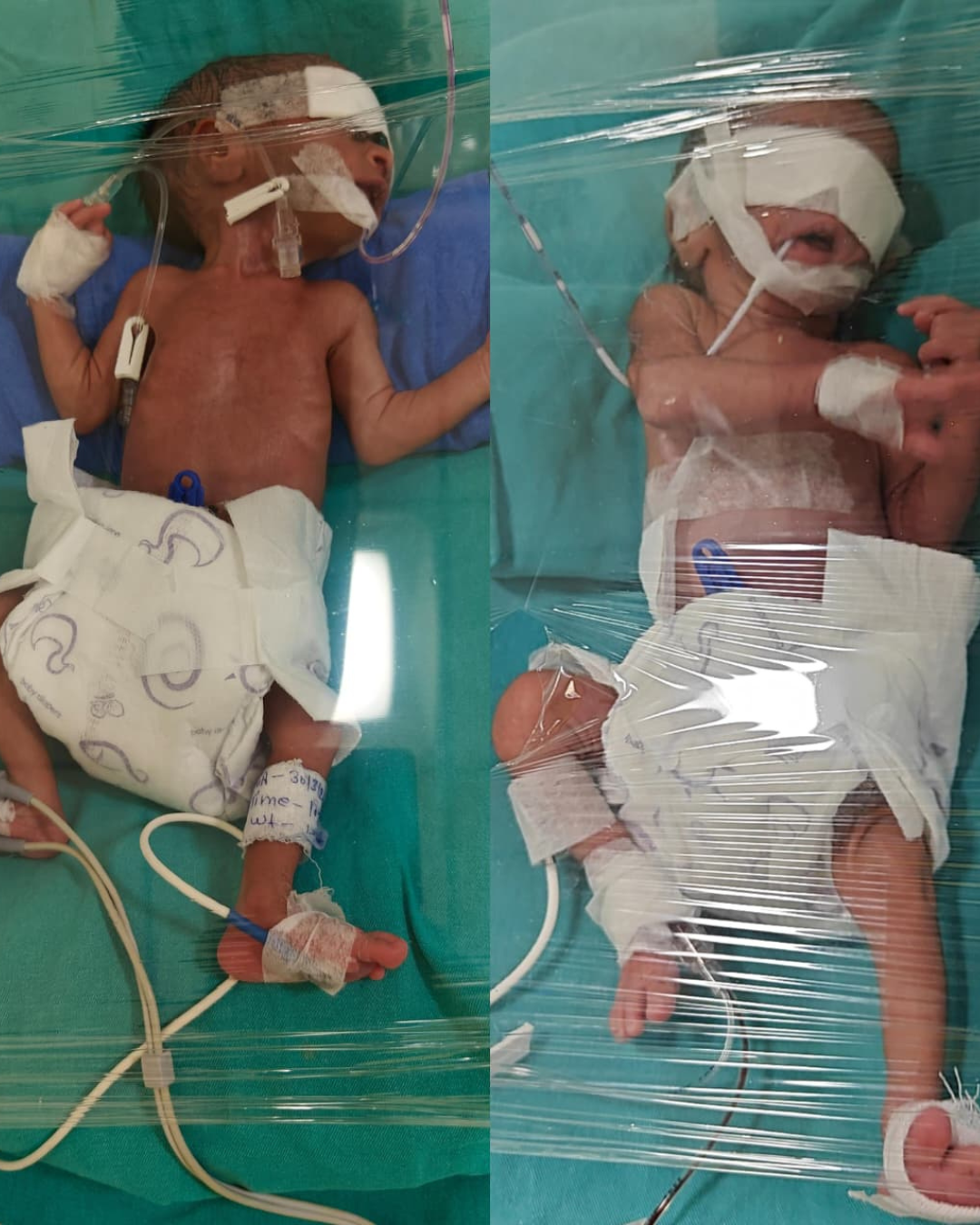 Kareena’s Twin Babies Need Your Help