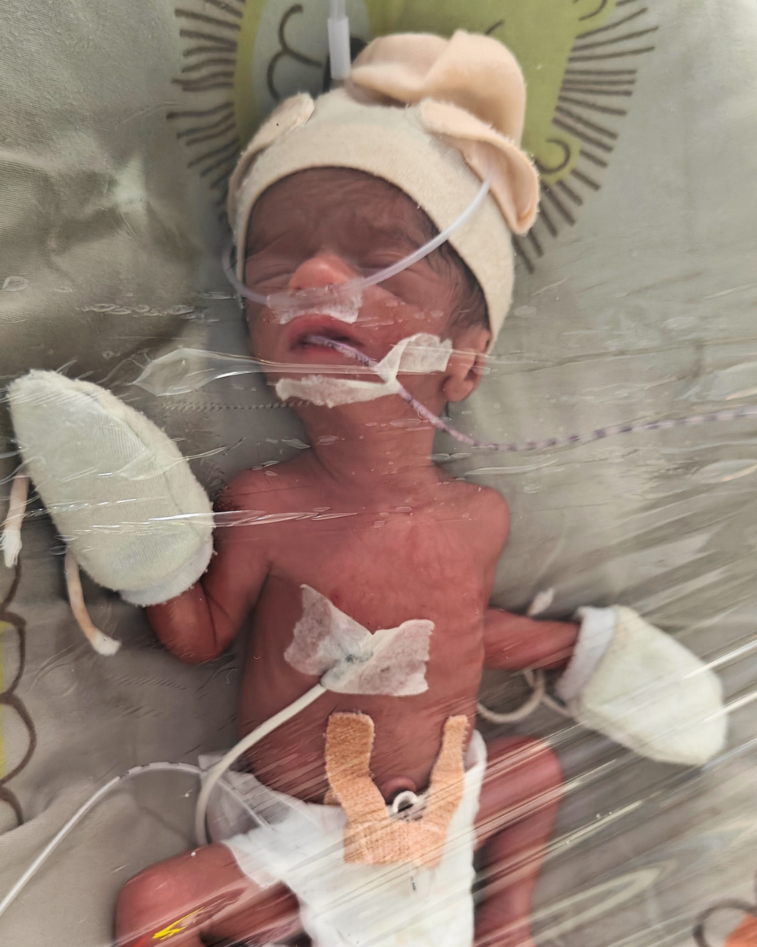 Baby of Anita Verma