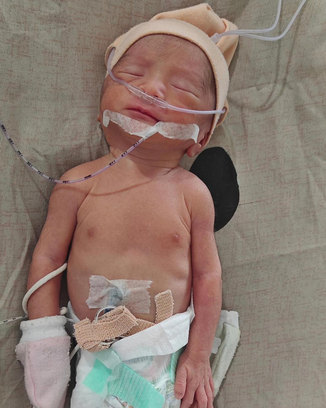 Help Baby of Bharti Barman