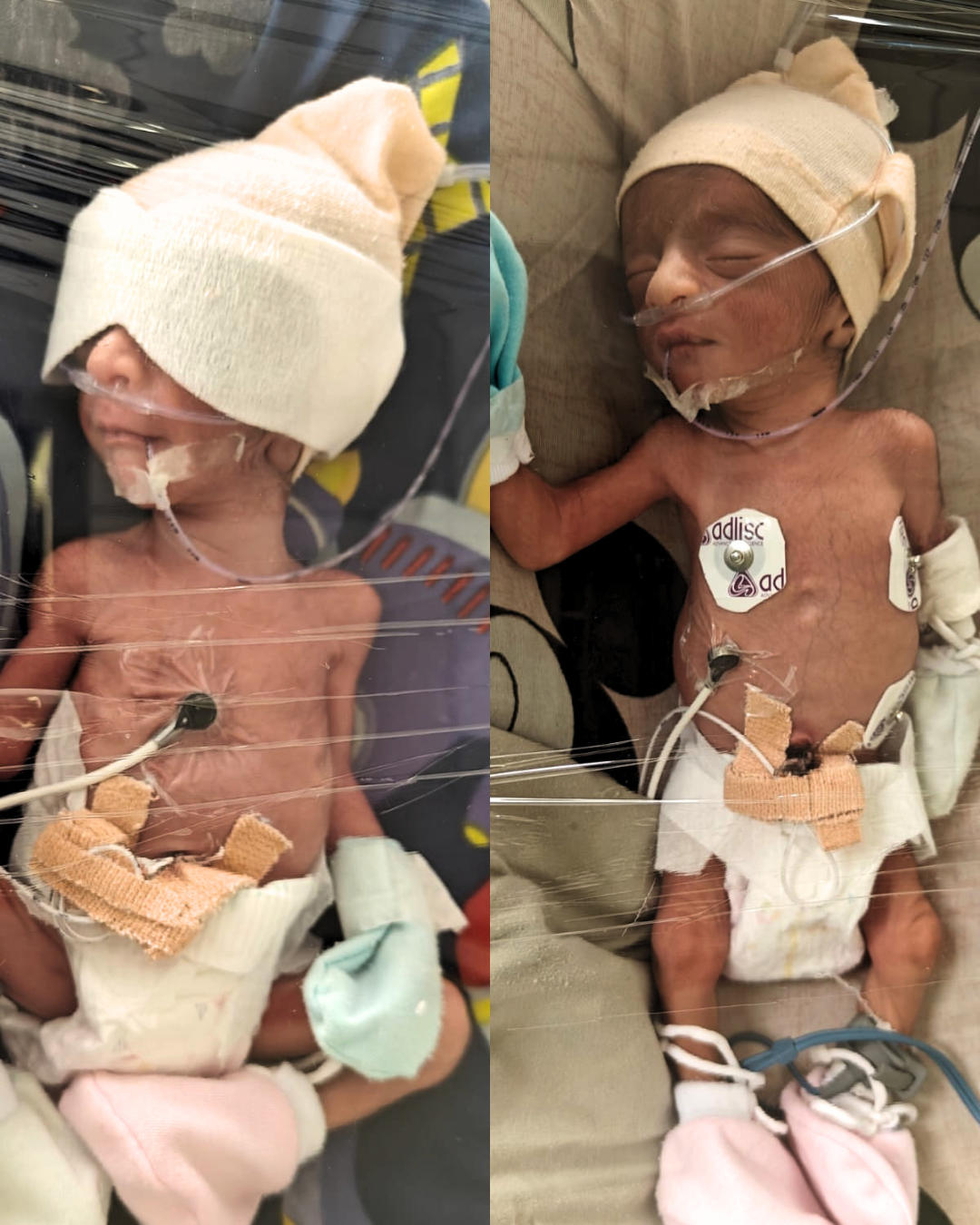 Twin babies of Anita Saini